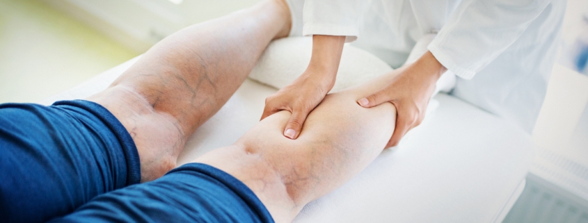 How Can a Vein Specialist Help Treat Cardiovascular Conditions? | Missouri Vein Specialists