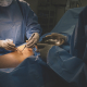 vein surgeon operation surgeon on a patient